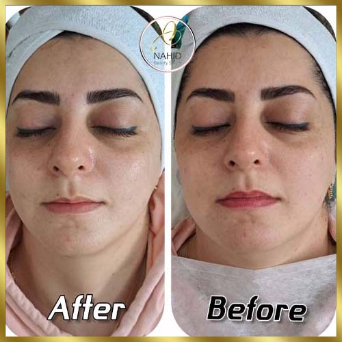 گالری پاکسازی پوست